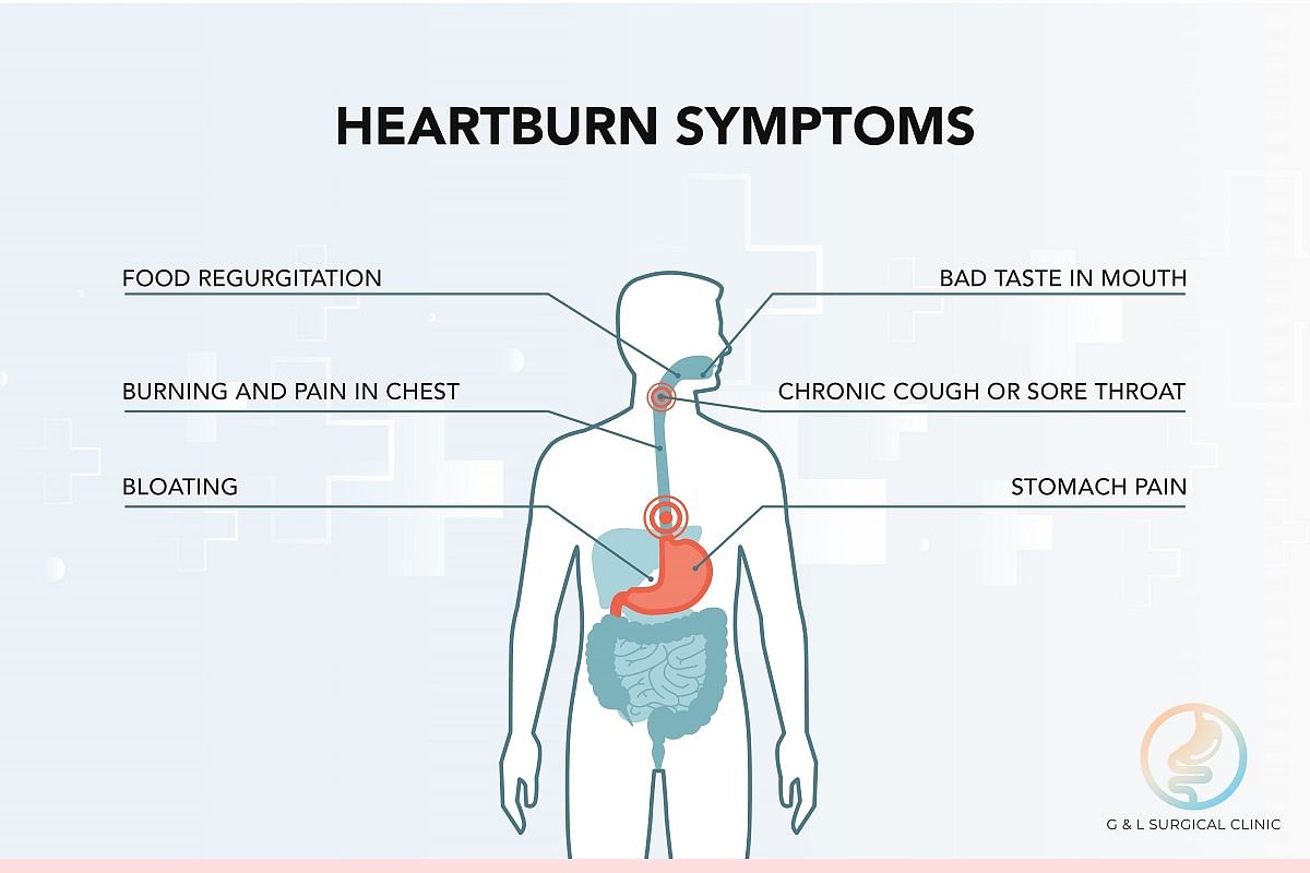 Always Suffering From Heartburn Or Acid Reflux You May Have A Digestive Disorder Health News Top Stories The Straits Times