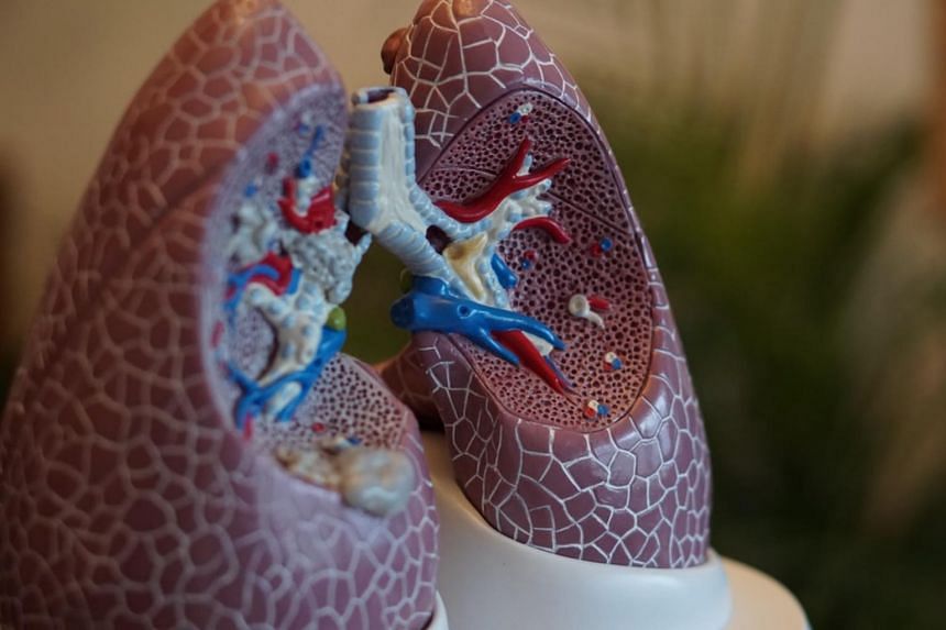 The patient's husband and son had donated part of their healthy lungs.